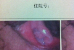 破处女膜视频,视频解析与科学解读